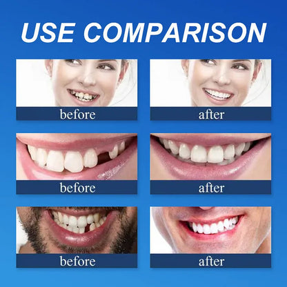 --Ends Today: 75% OFF! ⏰DarkFairy™ Medical Full Denture with Strong Suctiond Custom-Fit Full Functional Dentures🦷Obtain American Dental Association (ADA) Certification