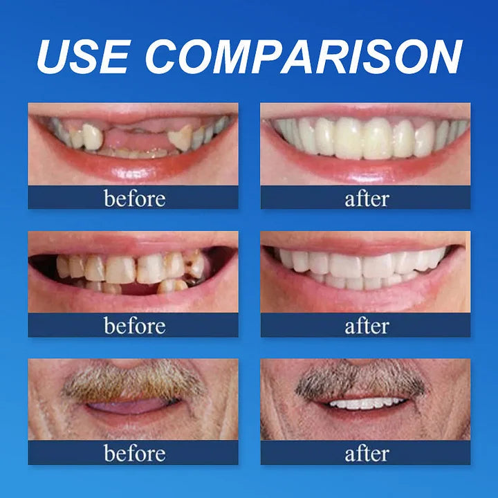 --Ends Today: 75% OFF! ⏰DarkFairy™ Medical Full Denture with Strong Suctiond Custom-Fit Full Functional Dentures🦷Obtain American Dental Association (ADA) Certification